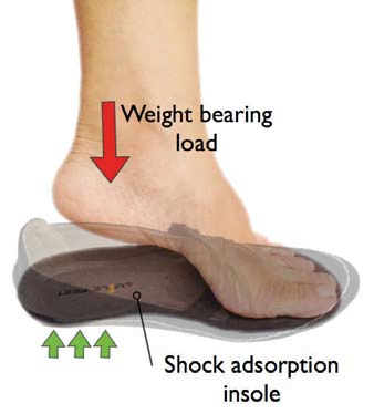 Chart for plantar fasciitis shoes support and load bearing design  